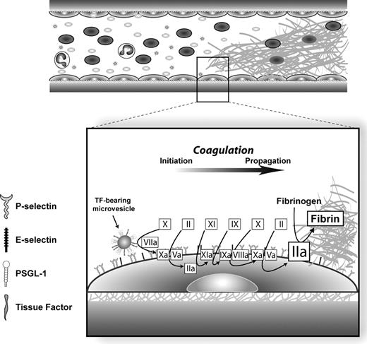 Figure 1. Model for venous thrombosis. / Abbreviations: Factor II, prothrombin; factor IIa, thrombin; PSGL-1, P-selectin glycoprotein ligand-1