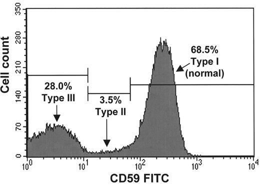 Figure 1. Flow cytometry to diagnose paroxysmal nocturnal hemoglobinuria (PNH) and to quantitate the clone. / A. Demonstrates a population comprising 28% of the red cells that are completely deficient in CD59 (and other glycosylphosphatidylinositol (GPI)–linked antigens) and a second abnormal population of partially deficient red cells comprising 3.5% of the total. / B. Demonstrates the lack of more than one GPI-linked antigen (CD16 and CD24) from the same patient’s granulocytes. / C. Demonstrates that the proportion of PNH monocytes usually closely corresponds to the granulocyte analysis. (Courtesy of Dr. S.J. Richards)