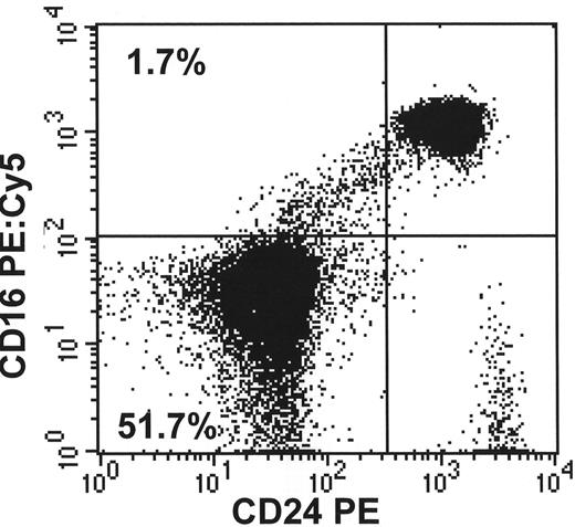 Figure 1. Flow cytometry to diagnose paroxysmal nocturnal hemoglobinuria (PNH) and to quantitate the clone. / A. Demonstrates a population comprising 28% of the red cells that are completely deficient in CD59 (and other glycosylphosphatidylinositol (GPI)–linked antigens) and a second abnormal population of partially deficient red cells comprising 3.5% of the total. / B. Demonstrates the lack of more than one GPI-linked antigen (CD16 and CD24) from the same patient’s granulocytes. / C. Demonstrates that the proportion of PNH monocytes usually closely corresponds to the granulocyte analysis. (Courtesy of Dr. S.J. Richards)