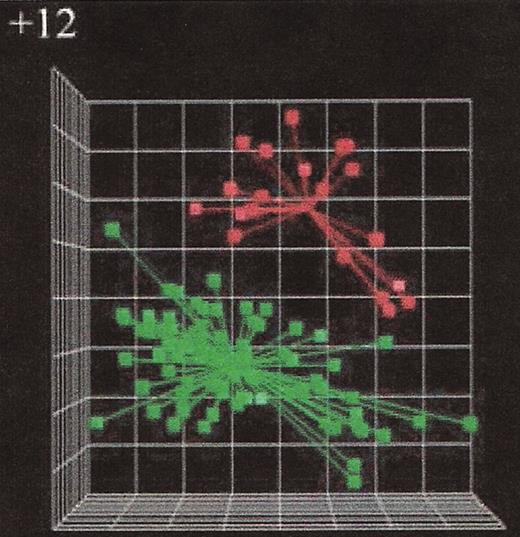 Stilgenbauer Figure 5. (in Byrd et al). Microarray gene expression analysis of chronic lymphocytic leukemia (CLL) cases with or without trisomy 12.25. / The principal component analysis of the first three principal components defined by the predictor variables shows a clear separation of the cases with trisomy 12 (red symbols in the right upper quadrant) from the cases without trisomy 12 (green symbols in the lower left quadrant) indicating distinct gene expression signatures when comparing CLL groups with different genomic aberrations.