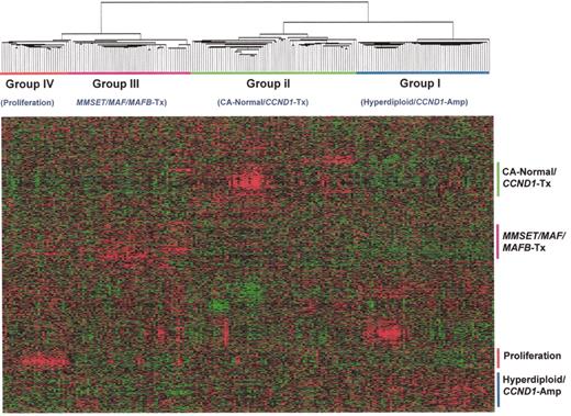 Shaughnessy Figure 1. (in Harousseau et al). Hierarchical cluster subgroups are correlated with distinct cytogenetic and molecular genetic abnormalities. / Using normalized expression levels of 4580 genes, a 2-dimensional unsupervised hierarchical clustering analysis was performed on CD138-enriched myeloma cells from 221 newly diagnosed myelomas. The hierarchical clustering was performed using the Average Linkage Clustering with center correlation. Two major cluster branches are created containing Hyperdiploid/CCND1 Low and Normal karyotypes and CCND1 spikes defining another. The other branch consisted of two groups defined by a proliferation signature and the other harboring virtually all MMSET, MF, and MAFB spikes. Cluster groups, designated I, II, III, and IV, are indicated.