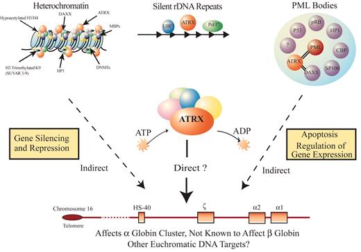 Higgs Figure 7. A model for how ATRX might influence gene expression. / ATRX is part of a multiprotein complex that uses the energy of ATP hydrolysis to remodel chromatin and/or its associated DNA in a way that affects transcriptional activity at euchromatic loci, including the α globin gene cluster. This interaction may be a result of alteration of the regional distribution of heterochromatin by the complex and/or recruitment of transcription factors (either directly or indirectly) that alter gene expression. ATRX function may be associated with its presence at one of its target nuclear locations (e.g., heterochromatin, ribosomal DNA repeats, and/or PML bodies) in addition to euchromatic sites. Potential points for interaction between ATRX and myelodysplasia (MDS) leading to a more severe hematologic phenotype than in ATR-X syndrome include: (1) the multiprotein complex of which ATRX is a part, (2) the transcription factors whose binding to DNA is affected by the ATRX complex, and (3) epigenetic modifications of histone-associated DNA leading to alterations in chromatin conformation.