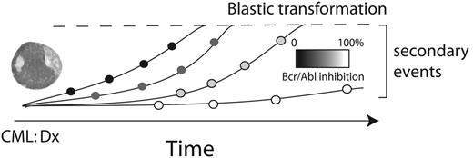 Figure 1. A working model depicting a link between BCR-ABL tyrosine kinase activity and the accumulation of secondary genetic and epigenetic changes in CML progenitors over time. Once a threshold (at top) of secondary molecular events is reached, hematopoietic differentiation is lost, resulting in blastic transformation. Drugs with no effect on BCR-ABL tyrosine kinase activity would be associated with an inevitable progression to blast crisis (black circles). Complete suppression of BCR-ABL (white circles) in CML stem cells might prevent blastic progression indefinitely, while incomplete suppression (gray shaded circles) due to ineffective drug delivery or BCR/ABL kinase domain mutations would only delay the accumulation of secondary events.