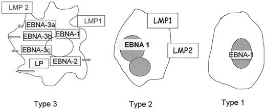 Figure 1. Types of Epstein-Barr virus latency. . / Abbreviations: EBV, Epstein-Barr virus; LP, leader protein; LMP, latent membrane protein; EBNA, EBV nuclear antigen