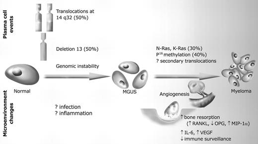 Figure 1. Pathogenesis and progression of monoclonal gammopathies.