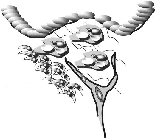 Figure 5. The clinically important lesion is characterized by intimal narrowing, many foam cells, neovascularization and flow-limiting narrowing. However, this stage of the disease is sufficiently advanced that treatments aimed at it do not impact the pathogenesis of the underlying disorder.