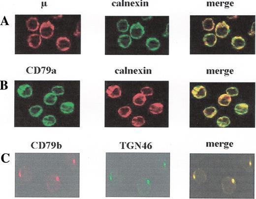Figure 1B. Analysis of the subcellular localization of the various B-cell receptor (BCR) components by immunofluorescence microscopy. Fixed and permeabilized chronic lymphocytic leukemia (CLL) B cells were incubated with various combinations of mAbs as follows: anti-anticalnexin and anti-m (A), anti-C79a and anticalnexin (B), and anti-CD79b and anti-TGN46 (C). Red and green images were collected and merged, with yellow coloration indicating co-localization. It is shown that there is co-localization of m and CD79a molecules with calnexin, indicating a retention of these molecules in the reticulum endosplasmic (RE) compartment. In contrast, CD79b co-localization with TGN46, which indicates that CD79b has not been retained in the RE compartment and attained the Golgi compartment.
