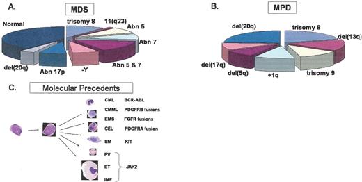 Look Figure 1. Common chromosomal deleted regions, duplications and other abnormalities associated with (A) MDS, (B) MPD and (C) activated kinases associated with MPD. The pie charts represent the percentages of patients with the indicated cytogenetic abnormalities estimated from the following studies: Fig. 1A, based on data in List AF et al, 2004 , and Fig. 1B from based on data in Bench.1 . / Abbreviations: CML, chronic myelogenous leukemia; CMML, chronic myelomonocytic leukemia, EMS, 8p11 myelo-proliferative syndrome; CEL, chronic eosinophilic leukemia; SM, systemic mastocytosis; PV, polycythemia vera; ET, essential thrombocythemia; IMF, idiopathic myelofibrosis. / Reproduced with permission from a slide provided by Dr. Anthony Green.