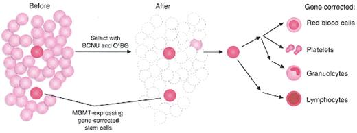 Walters Figure 3. Gene therapy with hematopoietic stem cells (HSCs) and post-transduction selection. 42 . / Limiting numbers of MGMT-expressing gene-corrected cells are expanded by initially killing most of the of untransduced HSCs with BCNU and O6-benzylguanine (O6BG) therapy. Self-renewal and expansion of MGMT gene-corrected HSCs repopulate all hematopoietic lineages. / Reprinted with permission from Bank A. Hematopoietic stem cell gene therapy: selecting only the best. J Clin Invest. 2003;112(10):1478–1480.