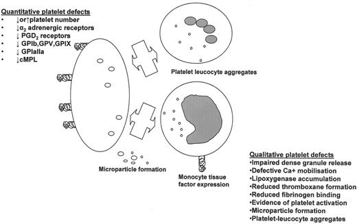 Figure 1. Platelet abnormalities in myeloproliferative disorders.