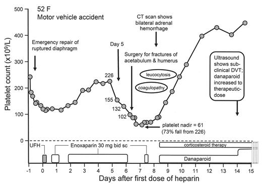 Figure 2. Bilateral adrenal hemorrhagic infarction complicating heparin-induced thrombocytopenia (HIT). / The patient, a 52-year-old female with serious injuries sustained in a motor vehicle accident, had a high pretest probability for HIT, based upon clinical events that occurred during the first 10 hospital days. The pretest probability score (4 T’s clinical scoring system) was 8 (the maximum score), based upon 55% platelet count fall (2 points) that began on day 5 of heparin therapy and that preceded the second operation (2 points), with thrombotic manifestations (bilateral adrenal infarction and deep-vein thrombosis; 2 points) without other apparent explanation (2 points). The clinical diagnosis was supported by strong positive testing for HIT antibodies (99% serotonin release; normal < 10%; 2.245 optical density units in an in-house anti-PF4/heparin ELISA that detects IgG class antibodies; normal < 0.450 units). Coagulopathy (elevated INR) and leukocytosis were attributed to HIT and the early stages of adrenal crisis, respectively, and both abnormalities resolved with danaparoid anticoagulation and corticosteroids. The patient was switched from prophylactic-dose to therapeutic-dose danaparoid when routine duplex ultrasound detected a subclinical DVT involving a small area of the left femoral and popliteal veins. / Abbreviations: bid, twice-daily; DVT, deep-vein thrombosis; sc, subcutaneous; UFH, unfractionated heparin.