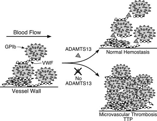 Figure 1. Pathogenesis of idiopathic thrombotic thrombocytopenic purpura (TTP) caused by ADAMTS13 deficiency. / Multimeric von Willebrand factor (VWF) adheres to endothelial cells or to connective tissue exposed in the vessel wall. Platelets adhere to the VWF through platelet membrane glycoprotein GPIb. In flowing blood, VWF in the platelet-rich thrombus is stretched and cleaved by the metalloprotease ADAMTS13, limiting thrombus growth. If ADAMTS13 is absent, VWF-dependent platelet accumulation continues, eventually causing microvascular thrombosis and TTP.