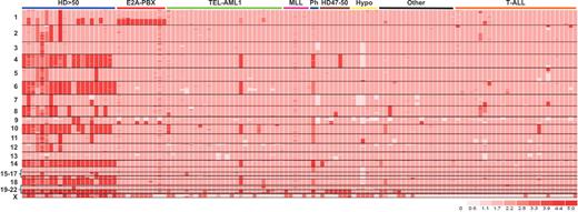 Downing Figure 2. Heat map showing DNA copy number changes in a representative sample of 123 pediatric acute lymphoblastic leukemia (ALL) cases. The map was generated using dChipSNP and a Hidden Markov Model copy number inference algorithm. Each case is represented by a column and single nucleotide polymorphisms (SNPs) are arranged in rows by chromosomal location. Pink represents diploid copy number, light pink mono-allelic deletion, white bi-allelic deletion, and red amplification.
