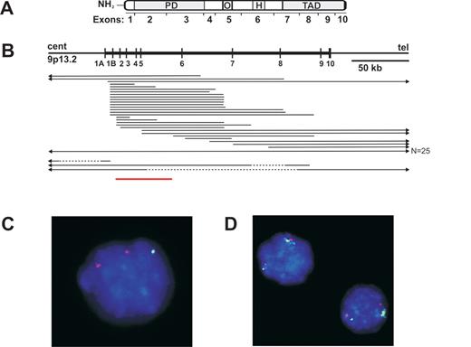 Downing Figure 4. Schematic representation of PAX5 deletions in pediatric acute lymphoblastic leukemia (ALL). / (A) PAX5 domain structure. PD, paired domain; O, octomer; H, homeodomain-like; TAD, transactivation domain. (B) PAX5 genomic organization and extent of PAX5 hemizygous deletions (solid line), homozygous deletions (dashed line), and amplification (red line). (C–D) Fluorescent in situ hybridization of interphase nuclei showing mono-allelic deletion (C) and focal internal amplification of PAX5 (D) within leukemic blasts. PAX5 probe is green, control probe red.