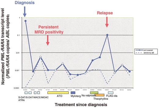 Lo-Coco Figure 2. Serial MRD monitoring for the PML-RARα fusion by real-time quantitative RT-PCR (RQ-PCR). / This figure demonstrates fluctuation in PML-RARα transcript copy numbers normalized to ABL (bold blue line) in serial marrow samples taken over the treatment course of this patient, initially treated in the UK MRC AML12 trial. The sensitivity for each assay is calculated on the basis of ABL expression in the given sample and the difference in Cycle threshold value (ΔCt) between PML-RARα and ABL at diagnosis and is denoted by the dotted line. Samples testing PCR positive are indicated by filled blue circles and PCR negative by white circles (for samples testing PCR negative, the sensitivity and normalized fusion gene copy number data points are superimposed). This analysis demonstrates the advantages of RQ-PCR to investigate kinetics of molecular response and relapse, as well as identifying poor quality samples likely to give “false negative” results. A 3-log reduction in PML-RARα transcript level was observed following induction; the post-course 2 sample afforded a sensitivity of <1 in 500 and hence yielded a “false-negative” PCR result. The patient was retreated at the point of molecular relapse with arsenic trioxide (ATO), which led to a net reduction in PML-RARα fusion transcript levels. The patient was considered unfit for further intensive therapy at that stage; subsequent sequential monitoring revealed a steady rise in PML-RARα transcript levels, successfully predicting a frank hematological relapse within 5 months. The patient received re-induction therapy, achieving PCR negativity at a sensitivity of 1 in 1000. Further recurrence of PCR positivity predicted a subsequent relapse. / (Figure courtesy of D.Grimwade, Y. Hasan and E. Nugent).