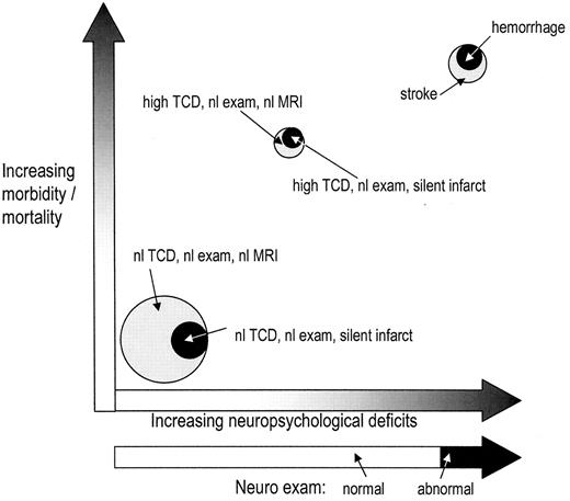 Figure 1. Estimates of morbidity/mortality, and impact on neurological exam and neuropsychological test performance in patients with sickle cell anemia (SS). / The different SS clinical subgoups are represented by circles that approximate their relative numbers in a typical SS population in care at US institutions.