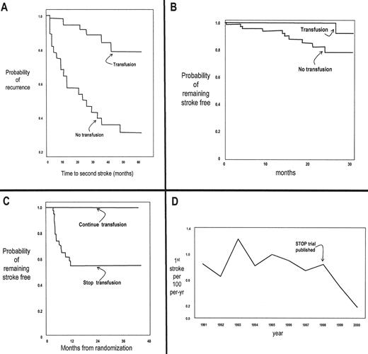 Figure 3. Growth in knowledge about stroke in sickle cell anemia (SS). / Panel A: Effect of chronic transfusion on recurrence after an initial episode of stroke.39
Panel B: Effect of chronic transfusion on stroke rate in an asymptomatic population without history of stroke shown to have elevated TCD.8 . / Panel C: Effect of discontinuing chronic transfusion on stroke rate in asymptomatic patients with elevated TCD who had been maintained on transfusion as shown in Panel B.40 . / Panel D: Incident rate of stroke in SS children living in California (CA), before and after publication of the paper illustrated in Panel B.9 (all figures were modified from the original papers)