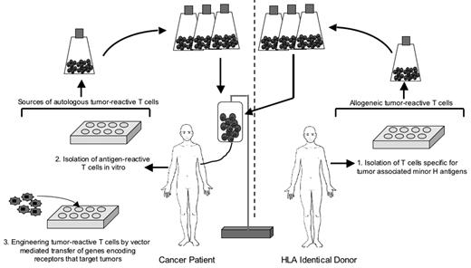Figure 1. Strategies for deriving autologous or allogeneic T cells for adoptive therapy of B-cell lymphoma.