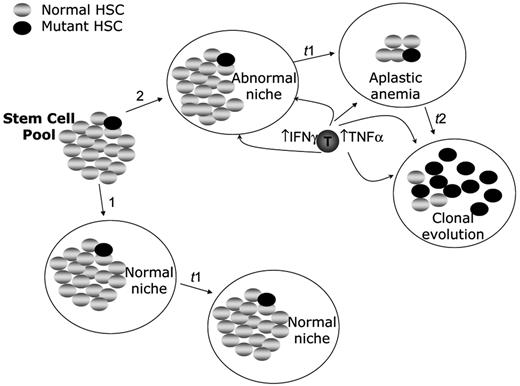 Figure 1. Coefficients of selection in normal bone marrow and in aplastic anemia. A hematopoietic stem cell (HSC) pool can reside in either a normal microenvironment (pathway arrow 1, “normal niche”) or within a hostile microenvironment (pathway arrow 2, “abnormal niche”). To emphasize the importance of the selection coefficient (low in pathway 1 and high in pathway 2), the pool of initially normal HSC contains one HSC with new alleles (bearing mutations of no consequence in the context of a normal niche). In the context of the hostile niche, the relative fitness of the same new alleles is massively amplified. Under the selective pressure of cytokines released by oligoclonal autoimmune T cells (“T”), the normal HSC are depleted over time (t1) and cytokine-resistant alleles are favored by selection because relative to the unfit wild-type stem cells, the mutant cells are much more fit. Under continued pressure from the aberrant T-cell population, the neoplastic clone preferentially expands over time (t2), while the less-fit normal HSC are selected against. In contrast, no evolution of the potentially neoplastic clone occurs in the supportive niche (pathway 1) because there is no selective pressure. That is, even though the phenotype of the mutant stem cell is the same as it was at the beginning of pathway 2, the fitness differences are not substantial enough to set the stage for clonal evolution. Not shown in this figure is a process by which a mutant stem cell arises in a population only after it is exposed to a hostile environment. This would meet strict genetic standards for an “adaptive mutation” in which the hostile environment per se induces mutations, some of which permit an adaptive response to the environment. The coefficient of selection idea would still be relevant here as well because relief of the environmental stress (e.g., effective immunotherapy of aplastic anemia) might lower the coefficient in time to prevent an outgrowth of adapted clonal progeny.