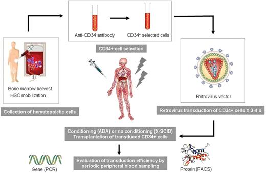 Dunbar Figure 1. Typical hematopoietic stem cell (HSC) gene therapy trial design. Marrow or mobilized peripheral blood cells are collected from patients, enriched for hematopoietic stem and progenitor cells via CD34+ selection, and exposed to retrovirus vector particles during in vitro culture. Transduced cells are then reinfused into the patient, either with or without prior myelosuppressive or ablative conditioning radiochemotherapy. Patients are then monitored for the presence of vector and corrective transgene expression in hematopoietic progeny cells.