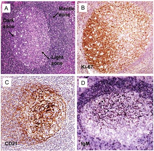 Natkunam Figure 3. Histologic and immunohistologic images of normal germinal centers. / (A) Hematoxylin and eosin-stained sections of a normal tonsil shows a germinal center with polarized dark and light zones. The dark zone shows rapidly proliferating cells as evidenced by increased mitotic activity and tingible body macrophages. The light zone is pale stained and shows a low proliferative activity; (B) An immunohistologic stain for Ki-67 (MIB1) highlights increased proliferation in one pole of the secondary follicle corresponding to the dark zone; (C) An immunohistologic stain for CD21 highlights the follicular dendritic cell meshwork within the germinal center; (D) An immunohistologic stain for IgM highlights immune complexes captured on follicular dendritic cell processes that are involved in antigen presentation to germinal center B-cells.