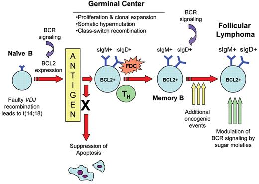 Natkunam Figure 4. Schematic representation of t(14;18)+ B-cell clones and the genesis of follicular lymphoma. Defective VDJ recombination leads to the t(14;18) translocation and aberrant BCL2 protein expression. Recent work by Roulland and colleagues52 suggests that antigen stimulation allows the t(14;18)+ B-cell in normal healthy individuals to enter the germinal center and undergo the germinal center reaction. Ectopic expression of BCL2 in the germinal center favors extended B-cell survival such that additional genetic changes are acquired by this B cell and may ultimately result in transformation to follicular lymphoma. In addition, N-glycosylation sites in Ig V regions by directly binding oligomannose sugars could modulate B-cell receptor-mediated signaling and contribute to follicular lymphoma pathogenesis.
