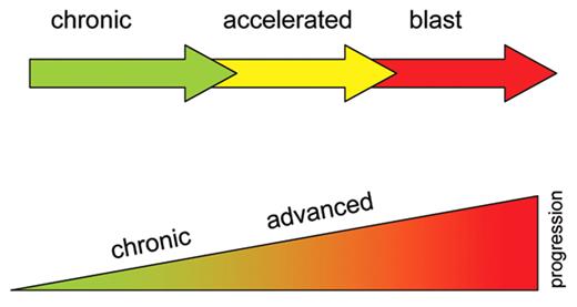 Figure 1. Conceptual models of CML progression. The upper panel shows the concept of stepwise progression of CML, with distinct clinical and pathological features. However, the data suggest the lower panel concept of a continual evolution of chronic phase through an advanced phase (accelerated and blast phases), with progression starting at the acquisition of the Philadelphia chromosome.