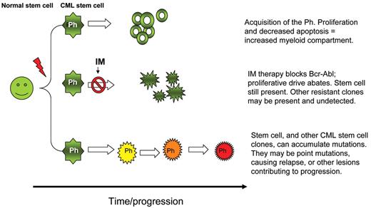 Radich Figure 2B. Progression in CML.