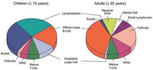 Sandlund Figure 2. Histologic types of non-Hodgkin lymphoma in children and adults, SEER, 2001–2004, ICDO-3 (source – SEER 17)