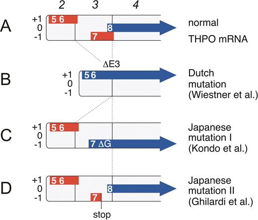 Skoda Figure 1. Effect of THPO gene mutations on the composition of uORFs in THPO mRNA. The main THPO mRNA transcribed from promoter 2 is shown. Boxes numbered in italic represent exons. The uORFs are drawn as thick red lines and are placed into one of the three reading frames (+1, 0, and −1). The THPO coding region is shown as a thick blue arrow. Numbers indicate the order in which the uAUGs appear in the full length THPO mRNA (uAUGs 1–4 are not shown). The eighth AUG is the physiological initiation codon. (A) Translation of normal THPO mRNA is physiologically almost completely inhibited by the presence of uORFs in the 5′-UTR. In particular, the uORF 7 is a potent inhibitor of translation, most likely because of its extension beyond the physiological start site. (B) A splice donor mutation in the Dutch HT family causes exon 3 skipping (DE3) that deletes uORF7 and shifts the THPO coding sequence into reading frame +1. Tpo translation now initiates from the fifth and sixth AUG. (C) The Japanese mutation I consists of a single G nucleotide deletion (DG) that shifts the THPO coding sequence into reading frame -1. Tpo translation now initiates from the seventh AUG. Note that both the Dutch and the Japanese mutation I create altered THPO signal peptides, but do not alter the sequence of the mature Tpo protein. Both signal peptides remain functionally active and promote secretion of a biologically active Tpo protein. (D) The Japanese mutation II creates a premature stop codon in uORF7. This allows re-initiation of translation at the physiological start site (the eighth AUG). / Figure reprinted from Cazzola and Skoda, Blood. 2000;95:3280–3288 © the American Society of Hematology