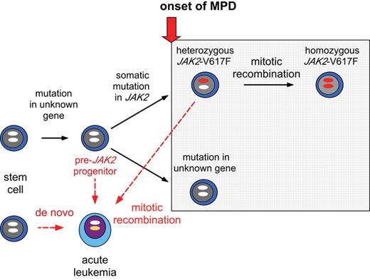 Skoda Figure 2. Model of the clonal progression in myeloproliferative disorder (MPD). The onset of MPD is preceded by a somatic mutation (sporadic MPD) or germ-line mutation (familial MPD) in an as yet unknown gene(s). The onset of MPD coincides with the acquisition of a mutation in JAK2 or other genes (gray box). Acute leukemia can arise de novo or from the MPD clone. Leukemic transformation of a “pre-JAK2” progenitor or stem cell could explain the absence of JAK2-V617F in leukemic blasts from MPD patients previously positive for JAK2-V617F. Alternatively, JAK2-V617F could be lost during mitotic recombination of a cell heterozygous for JAK2-V617F (dashed line).
