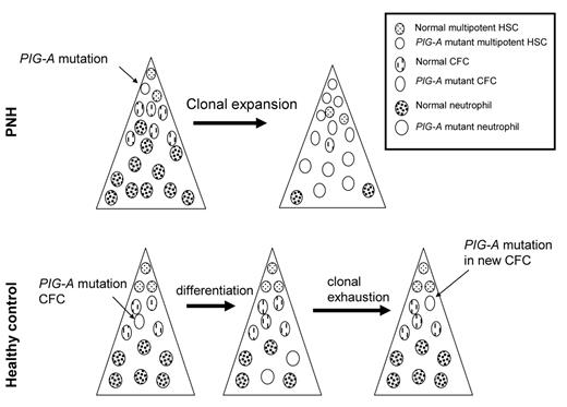 Figure 1. PIG-A mutations in health and disease. PIG-A mutations in PNH (upper panel) arise from a multipotent hematopoietic stem cell (HSC). Expansion and differentiation of the PIG-A mutant HSC results in clinical disease. In healthy control subjects, most, if not all, PIG-A arise from colony-forming cells (CFC). CFC can differentiate, but have no self-renewal capacity; hence, these PIG-A mutations do not result in disease.
