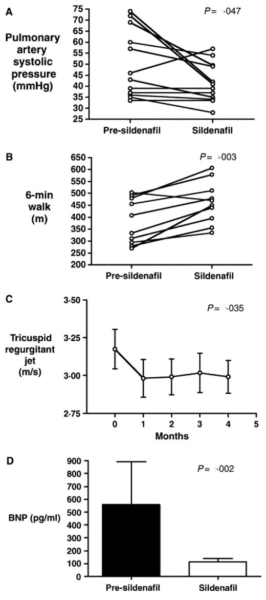 Figure 4. Results of a pilot clinical trial of sildenafil for pulmonary hypertension in sickle cell disease (SCD). Baseline measurements were made in 12 patients with SCD on hydroxyurea, and then they were treated with oral sildenafil (25 to 100 mg 3 times daily) for up to 6 months. Sildenafil therapy significantly decreased estimated pulmonary artery systolic pressure (A) and improved 6-min walk distance (B). (C) Time course of the effects of sildenafil on tricuspid regurgitant jet velocity. (D) Decrease in plasma NT-pro-BNP levels with sildenafil therapy.18