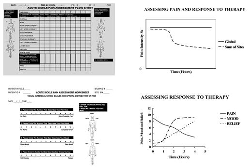 Figure 3. Assessment form that rates pain globally and at each painful site. Upper right panel: Assessment of pain and response to therapy illustrates change in sum of sites score when the global score does not reflect change. Lower left panel: modification of the Memorial Assessment Card39 using numerical rating scales for measuring pain, relief, mood and sedation Lower right panel: pain, relief and mood depicting response to therapy. As the pain is reduced, relief and mood increase indicating that mood disturbance was related to pain.