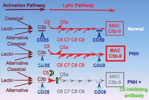 Bessler and Hiken (pp 104–110) Figure 6. Schematic representation of the complement cascade in normal individuals, in patients with paroxysmal nocturnal hemoglobinuria (PNH), and in patients with PNH receiving the C5 inhibiting antibody eculizumab (modified from Bessler 2005).49 In humans the complement system consists of more than 30 plasma and cell-surface proteins and may be activated by three different pathways: the classical, lectin, and alternative pathway. The classical pathway is activated by antibody–antigen complexes, the lectin pathway involves carbohydrate recognition by pattern-recognition receptors, such as mannose-binding lectin (MBL) and the subsequent activation of MBL-associated serine proteases. The alternative pathway does not involve specific recognition molecules. It is initiated by the covalent binding of a small amount of C3 to hydroxyl or amine groups on the cell-surface molecules of microorganisms. This pathway also functions to amplify the activation of C3. The primary goal of the activation pathway is C3b deposition on the target cell. The activation pathway is followed by the formation of the membrane attack complex (MAC) in the lytic pathway of complement activation, which is necessary for the lysis of the target: C3b, once deposited on the target cells, becomes part of a C5 convertase. After C5b is formed by the C5 convertase, no further proteolytic reaction occurs in the complement cascade. The assembly of the MAC is formed by protein-protein interaction. The deficiency of the surface proteins CD55 and CD59 leads to the uncontrolled lysis of PNH red cells by complement. The C5 binding antibody blocks the lytic pathway of complement activation. Reproduced with permission from Bessler M. Inside blood. Blood. 2005:106:2224. 49