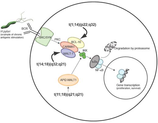 Kahl and Yang (pp 359–364) Figure 2. Activation of NF-κB and chromosomal translocations found in MALT lymphoma. Epitopes from Helicobacter pylori can lead to activation of NF-κB through the B-cell receptor (BCR) via receptor-associated tyrosine kinases of the SRC and SYK family, which signal a protein kinase C (PKC) family member to oligomerize BCL-10, CARMA1, and MALT1 leading to activation of the inhibitor of NF-κB kinase (IKK) complex. The IKK complex phosphorylates the inhibitor of NF-κB (IκB) prompting its degradation by the proteasome and allowing the NF-κB family members to translocate to the nucleus and control NF-κB–dependent gene expression. The t(1;14) and t(14;18) translocations lead to overexpression of the BCL10 and MALT1 genes respectively and the t(11;18) translocation produces a chimeric API2-MALT1 protein that can directly activate the IKK complex. Constitutive activation of the NF-κB pathway by these translocations bypasses the requirement for BCR signaling and may account for the antigen independence of cells harboring these translocations.