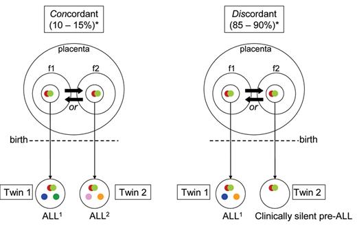 Figure 3. Acute lymphoblastic leukemia (ALL) in monozygotic/monochorionic twins.
Diagram illustrating sequence and developmental timing of critical mutational events in ALL in monozygotic twins (with one placenta) with either concordant (shared) ALL or discordant ALL (ie, in one twin only).
Fusion gene (= initiating lesion).
Copy number variation (secondary, postnatal gene deletions or gains).
*Concordant/discordant percentages. Probability that second twin will develop ALL after it is diagnosed in first twin.
f1, f2 Fetus.
Transmission of pre-leukemic clone from one twin to the other (via intra-placental vascular anastomoses). Direction of transfer unknowable.