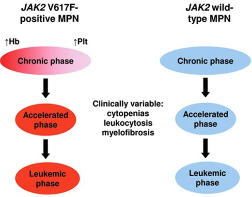 Figure 3. Model to explain the relationship of essential thrombocythemia, polycythemia vera and primary myelofibrosis. Whereas a phenotypic overlap exists between JAK2 V617F–positive polycythemia and thrombocythemia, JAK2 V617F–negative disease is both biologically distinct and heterogeneous, including 10% of patients with MPL mutations and 90% in whom the molecular cause is currently unknown. Accelerated phase disease may follow JAK2 V617F–positive or –negative chronic phase and is clinically variable, including bone marrow fibrosis, increasing or falling white cell count or splenomegaly. A minority of patients undergo disease evolution to acute myeloid leukemia. In this model, patients currently labeled as having primary myelofibrosis may in fact represent those presenting in accelerated phase of a pre-existing myeloproliferative neoplasm (MPN).
Hb indicates hemoglobin; Plt, platelet count.