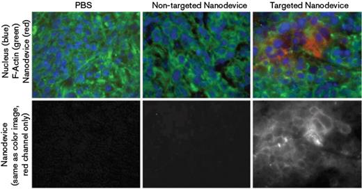Figure 8. Fluorescence images of mouse KB cell tumor, harvested 15 hours after injection. There is greatly enhanced uptake of the folic acid targeted material by the tumor.