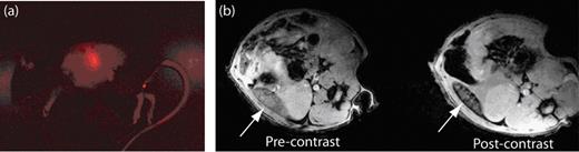 Figure 3. Fluorescent and magnetic resonance (MR) images revealing the biodistribution of B cells in mice. (a) Fluorescent image of a mouse that has been injected with B cells that have been labeled with ultrasmall superparamagnetic iron oxide (USPIO) and the fluorescent dye CellVue® NIR815. The fluorescent image clearly shows the localization of B cells within the spleen. (b) MR images of the spleen (white arrow) before and after the injection of the USPIO-loaded B cells. The migration of USPIO-loaded B cells to the spleen results in a loss in signal intensity on T2-weighted images.