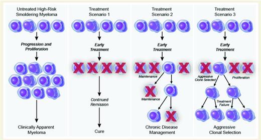 Figure 1. Theoretically possible scenarios resulting from early treatment of smoldering myeloma. Progression of untreated high-risk SMM to full-blown MM is shown on the left. SMM patients with two or three risk factors (see Table 1) have a median TTP of 5 and 2 years, respectively. Scenarios 1 to 3 illustrate possible scenarios resulting from early treatment of SMM: Scenario 1 (center left) represents a complete cure of MM, which has not yet been reliably achieved by any current treatment modalities. This would likely require more intense treatment, necessitating improved risk-stratification of patients. Ultimately, targeted therapies may be able to achieve cure. Scenario 2 (center right) represents the generation of a chronic, asymptomatic disease state requiring ongoing maintenance therapy. This is a likely outcome of using immunomodulatory and targeted agents available in the near future. Scenario 3 (right) illustrates the theoretical possibility of the selection of a particularly aggressive, resistant clone. While TTP is extended in this scenario, overall survival may not be improved, because symptomatic disease might progress unchecked if available treatments become less effective following early treatment. Future studies are needed to fully explore these possibilities. Taken together, we do not know which, if any, of these scenarios are true. Therefore, clinical trials aimed at developing treatments for SMM should incorporate well-designed correlative studies to examine the biology of treatment response. (Reprinted with permission from Waxman et al., 2010.43)
