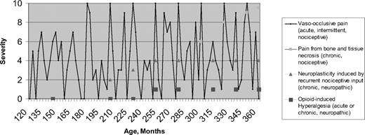 Figure 1. Conceptual model of etiologies and temporal evolution of pain in SCD. Multiple etiologies may be present in any one patient.