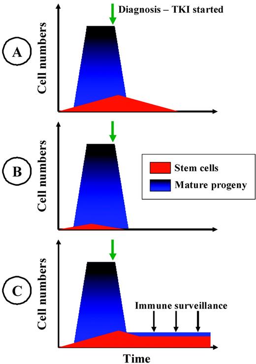 Figure 1. Three hypothetical models of operational cure of CML. The models are not mutually exclusive. Different models may pertain in different individuals. (A) Stem-cell depletion. The progressive depletion of immature CML cells over years of continued therapy is shown. The risk of relapse on TKI cessation is related to the duration of therapy and the intrinsic sensitivity of CML stem and early precursor cells. (B) Stem-cell exhaustion. The CML stem-cell pool is relatively small and, due to stochastic events that direct self-renewal or proliferation, this pool of cells may become extinct before diagnosis or early in therapy. The risk of relapse upon TKI cessation is related to the depletion of committed CML progenitors and progeny. (C) Immunological control. A reduction in the level of MRD by TKI therapy is sufficient to overcome T-cell anergy and enables the emergence of an autologous immunological response that suppresses, but may not eradicate, the CML clone. The risk of relapse on TKI cessation is dependent on the functional immune response and the intrinsic immunogenicity of the CML cells.