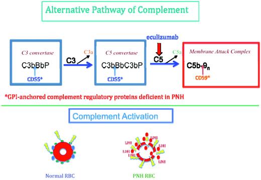 Figure 1. Complement-mediated lysis of PNH erythrocytes. Top panel shows that the C3 convertase (left blue rectangle) of the APC consists of activated C3 (C3b), activated factor B (Bb, the enzymatic subunit of the complex), and factor P (a protein that stabilizes the complex, formally called properdin). The C5 convertase (right blue rectangle) has the same components as the C3 convertase except that 2 C3b molecules are required to bind and position C5 for cleavage by activated factor B (Bb). C3a and C5a are bioactive peptides that are generated by cleavage of C3 and C5, respectively, by their specific activation convertases. The C3 and C5 convertases greatly amplify complement activation by cleaving multiple substrate molecules. The MAC (red rectangle) consists of activated C5 (C5b), C6, C7, C8, and multiple molecules of C9 (C9n). The MAC is the cytolytic unit of the complement system. The GPI-anchored complement-regulatory protein CD55 restricts the formation and stability of both the C3 and the C5 amplification convertases by destabilizing the interaction between activated factor B (Bb) and C3b (indicated by the blue arrows), whereas GPI-anchored CD59 blocks formation of the MAC by inhibiting the binding of C9 to the C5b-8 complex (indicated by the brown arrow). Inhibition of MAC formation by the humanized anti-C5 mAb eculizumab (indicated by the red arrow) ameliorates the intravascular hemolysis of PNH. Bottom panel shows that normal erythrocytes (left) are protected against complement-mediated lysis (lightning bolts) primarily by CD55 (blue circles) and CD59 (green circles). Deficiency of these GPI-anchored complement-regulatory proteins results in APC activation on PNH erythrocytes (right). Consequently, MACs form pores in the red cell membrane, resulting in colloid osmotic lysis and release of hemoglobin (red circles) and other contents of the red cell, including LDH, into the intravascular space.