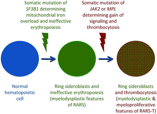 Figure 4. Schematic representation of the multistep molecular pathogenesis of RARS-T supporting its nature of true MDS/MPN (combination of SF3B1 and JAK2 or MPL mutations). The occurrence of a somatic mutation of SF3B1 causes mitochondrial iron overload, ineffective erythropoiesis, and anemia, typical myelodysplastic features of RARS. The subsequent occurrence of a somatic mutation of JAK2 or MPL involves the acquisition of myeloproliferative features, including thrombocytosis. This hypothetical model is based on data still unpublished at the time of this writing.