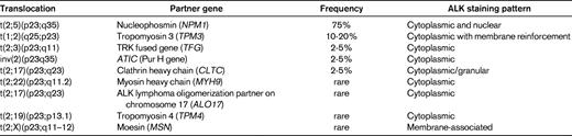 Translocations and fusion proteins in ALK-positive ALCL