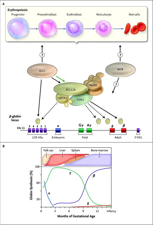 Figure 1. Molecular regulation of the fetal-to-adult hemoglobin switch. The human β-globin gene locus, which is located on chromosome 11, has a series of 5 genes that are developmentally expressed at distinct stages of human ontogeny (panel A bottom). The ε-globin gene is restricted to the transiently expressed embryonic primitive lineage of RBC produced in the first several weeks of gestation. The γ-globin genes encode the genes that uniquely form HbF, which is the predominant hemoglobin during the course of gestation. There is a switch to expression of the adult β-globin gene around the time of birth (B). B-cell lymphoma/leukemia 11A (BCL11A) and its protein partners, including GATA binding protein 1 (GATA1), zinc finger protein multi-type 1 (ZFPM1 or FOG1), and the nucleosome remodeling and deacetylase (NuRD) complex, bind to sequences within the globin locus (panel A tan ovals) and repress the expression of the γ-globin genes. Krüppel-like factor 1 (KLF1) interacts with this process by positively regulating the expression of BCL11A (green arrow in panel A) and also by directly binding to and promoting transcription of the adult β-globin gene. It is unknown whether KLF1 affects HbF expression through more global effects on erythropoiesis (panel A top), which may also be targeted by other factors associated with HbF (eg, MYB). HSs indicates DNase I–hypersensitive sites; LCR, locus control region. (Reprinted with permission from Sankaran and Nathan.7)