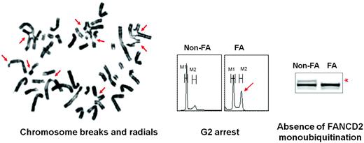 Figure 2. FA biological diagnosis is based on the hypersensitivity of FA cells to ICL agents.