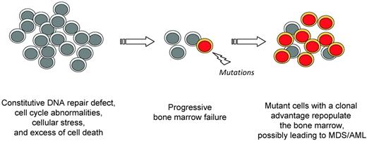 Figure 3. Frequent spontaneous clonal evolution in FA BM.