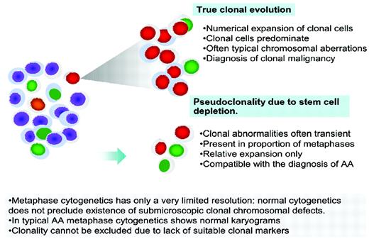 Figure 1. Clonality in AA. True clonal evolution and progression to MDS or AML has to be distinguished from pseudoclonality, which can be a result of a contracted stem cell pool and is characterized by a transient nature, lower proportion of metaphases with clonal markers, and often unusual breaks not typical of MDS.